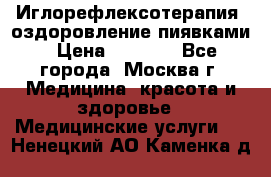 Иглорефлексотерапия, оздоровление пиявками › Цена ­ 3 000 - Все города, Москва г. Медицина, красота и здоровье » Медицинские услуги   . Ненецкий АО,Каменка д.